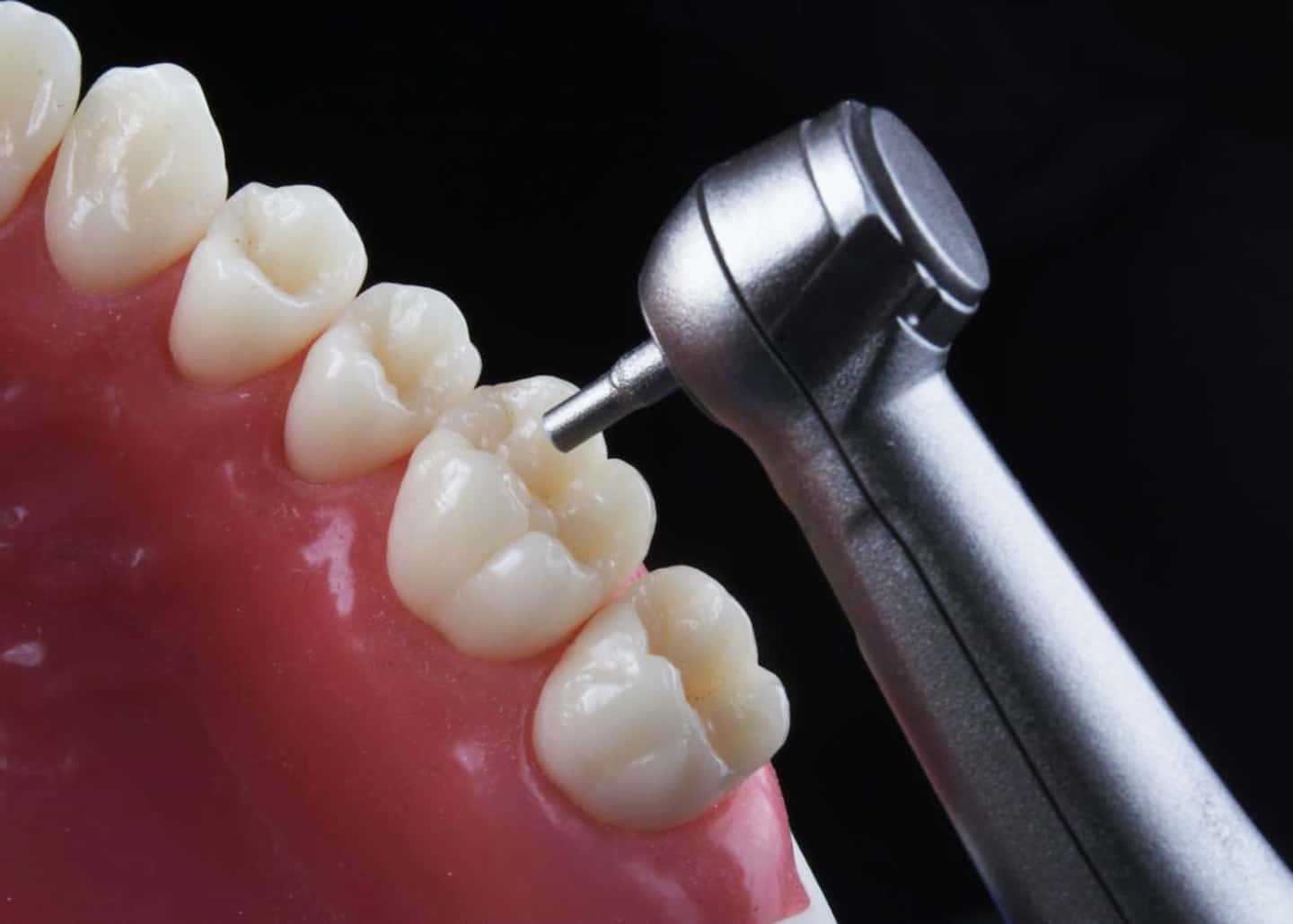 Invisalign Cost - Dentram Dental Clinics